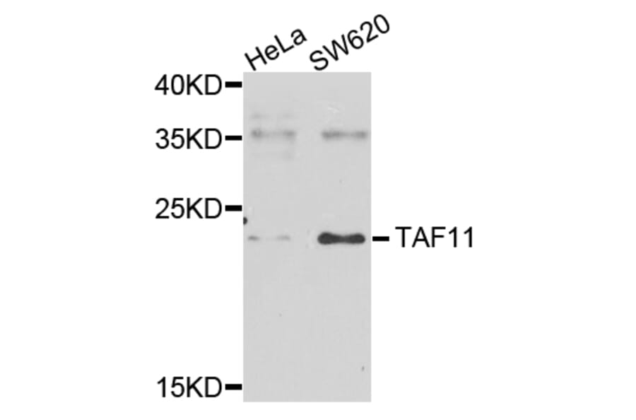 Western Blot - Anti-TAF11 Antibody (A7934) - Antibodies.com