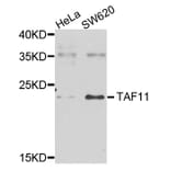 Western Blot - Anti-TAF11 Antibody (A7934) - Antibodies.com