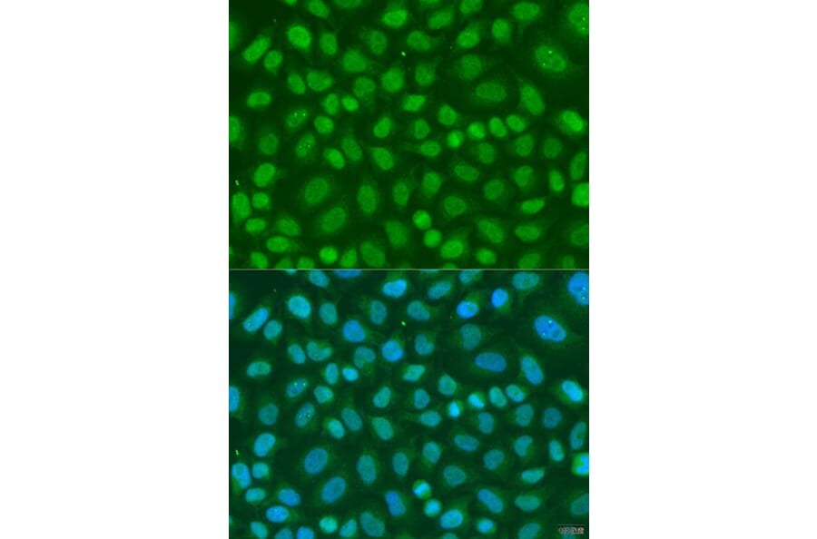 Immunofluorescence - Anti-TAF11 Antibody (A7934) - Antibodies.com