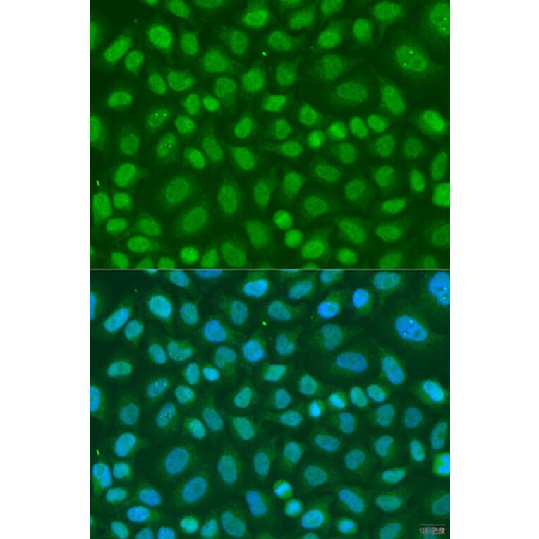 Immunofluorescence - Anti-TAF11 Antibody (A7934) - Antibodies.com