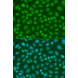 Immunofluorescence - Anti-TAF11 Antibody (A7934) - Antibodies.com