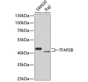 Western Blot - Anti-TFAP2B Antibody (A7935) - Antibodies.com