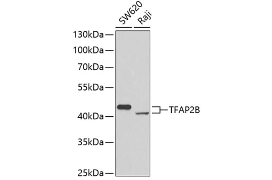 Western Blot - Anti-TFAP2B Antibody (A7935) - Antibodies.com