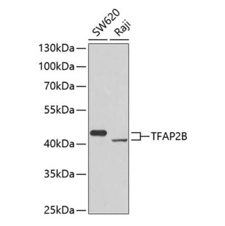 Western Blot - Anti-TFAP2B Antibody (A7935) - Antibodies.com