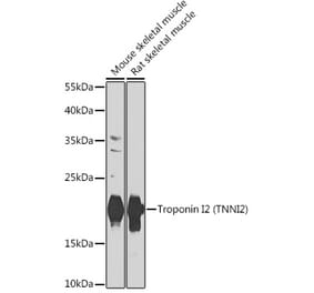 Western Blot - Anti-Troponin I fast skeletal muscle Antibody (A15987) - Antibodies.com