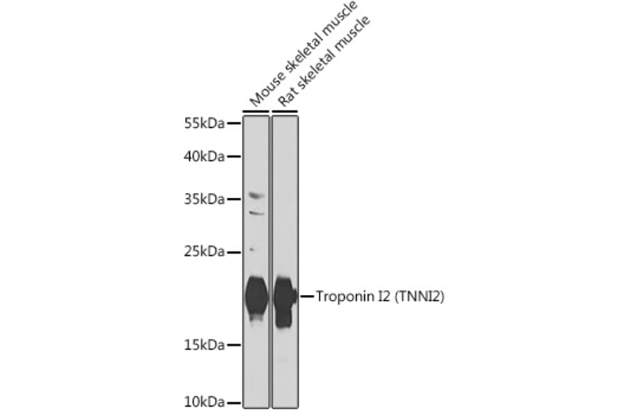 Western Blot - Anti-Troponin I fast skeletal muscle Antibody (A15987) - Antibodies.com