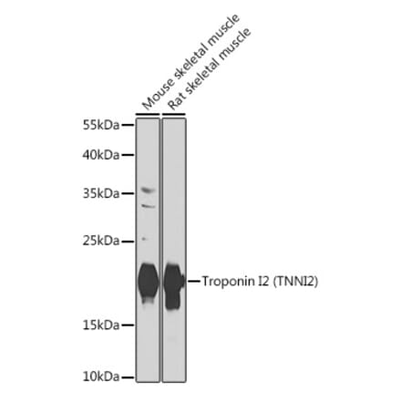 Western Blot - Anti-Troponin I fast skeletal muscle Antibody (A15987) - Antibodies.com