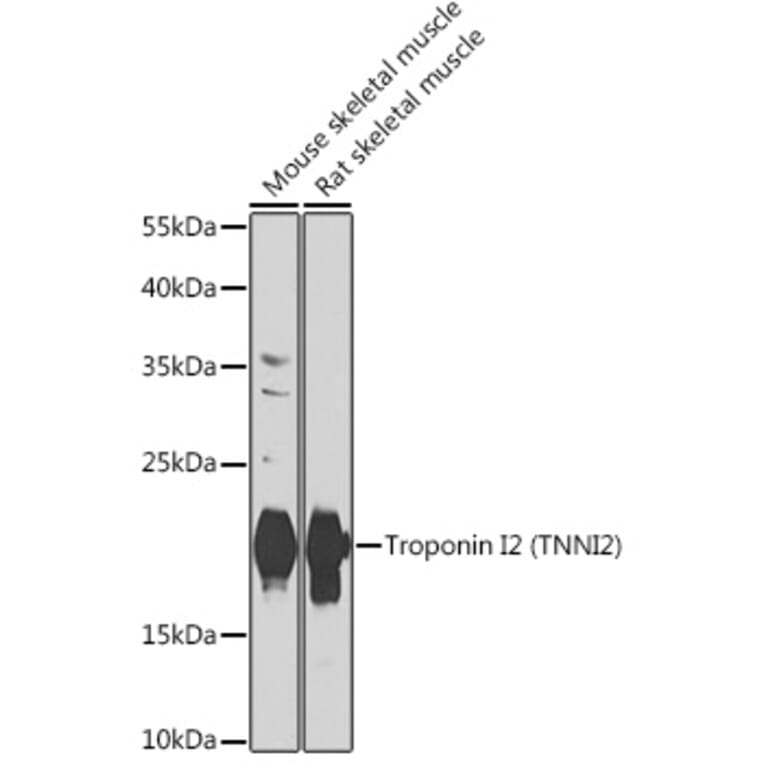 Western Blot - Anti-Troponin I fast skeletal muscle Antibody (A15987) - Antibodies.com