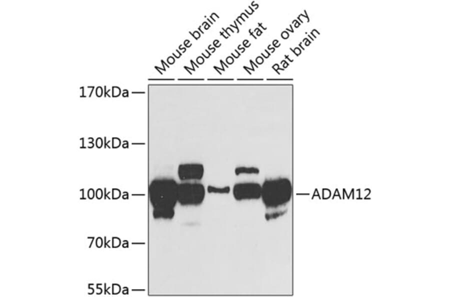 Western Blot - Anti-ADAM12 Antibody (A15989) - Antibodies.com