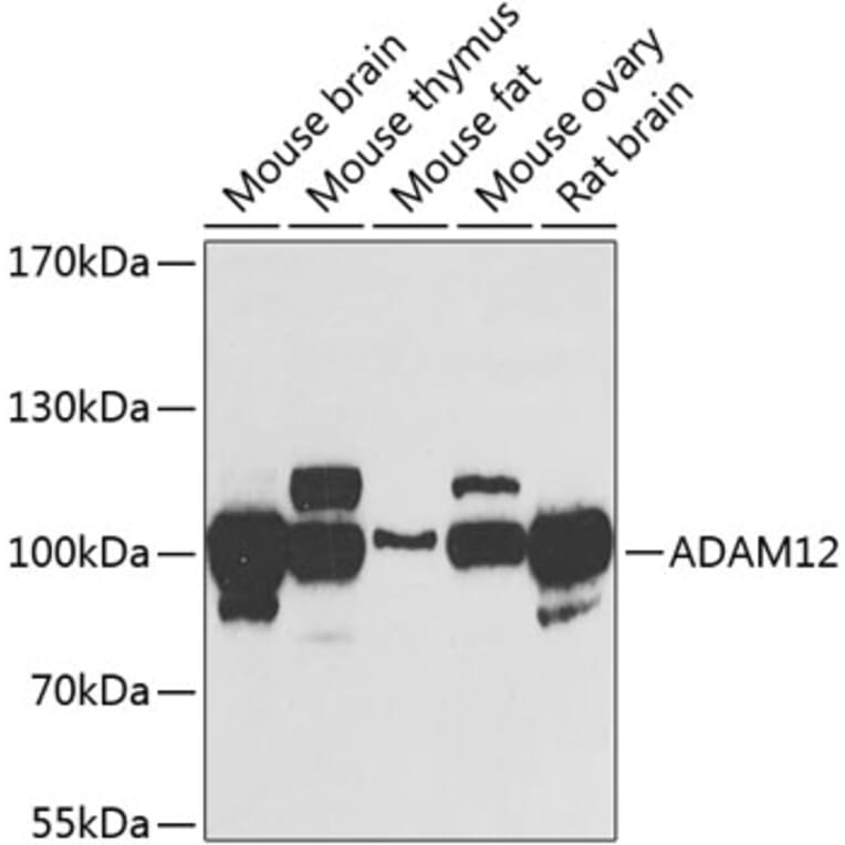 Western Blot - Anti-ADAM12 Antibody (A15989) - Antibodies.com
