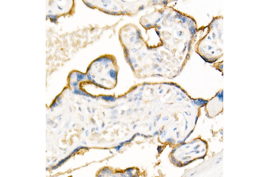 Immunohistochemistry - Anti-ADAM12 Antibody (A15989) - Antibodies.com