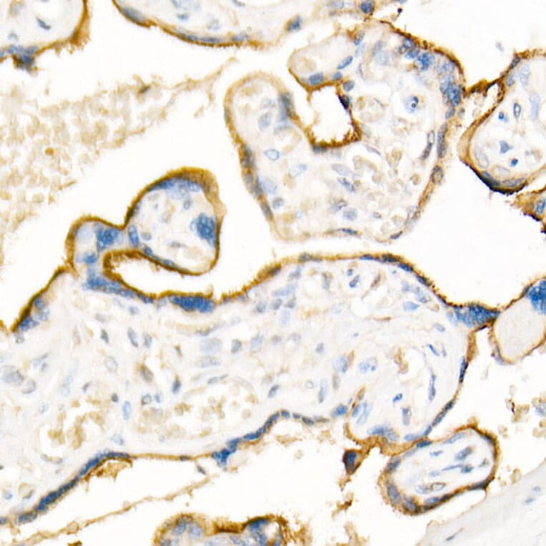 Immunohistochemistry - Anti-ADAM12 Antibody (A15989) - Antibodies.com