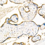 Immunohistochemistry - Anti-ADAM12 Antibody (A15989) - Antibodies.com