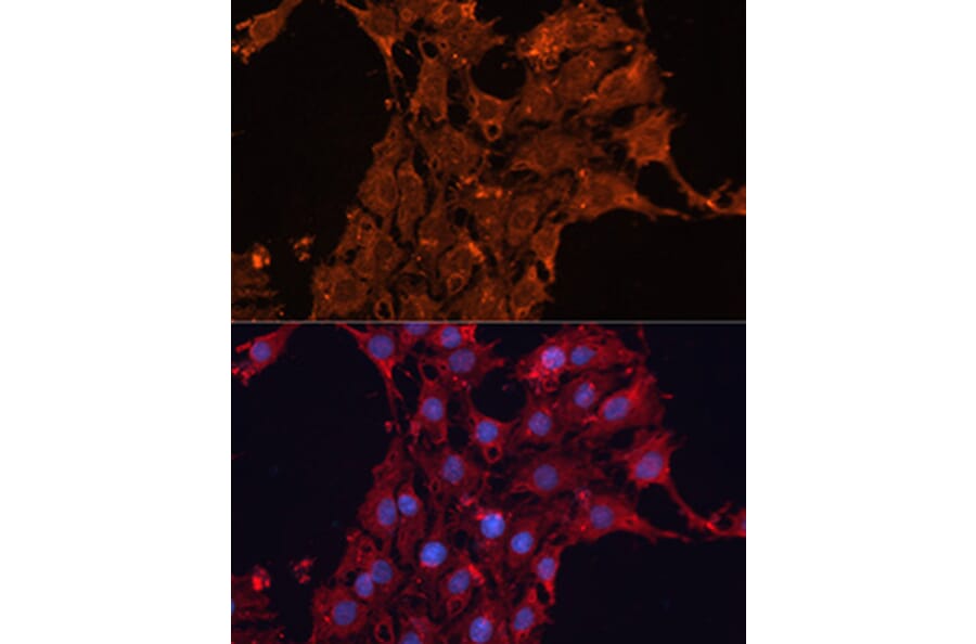 Immunofluorescence - Anti-ADAM12 Antibody (A15989) - Antibodies.com