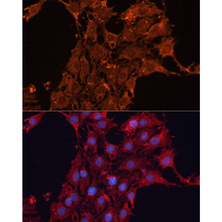 Immunofluorescence - Anti-ADAM12 Antibody (A15989) - Antibodies.com