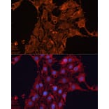 Immunofluorescence - Anti-ADAM12 Antibody (A15989) - Antibodies.com
