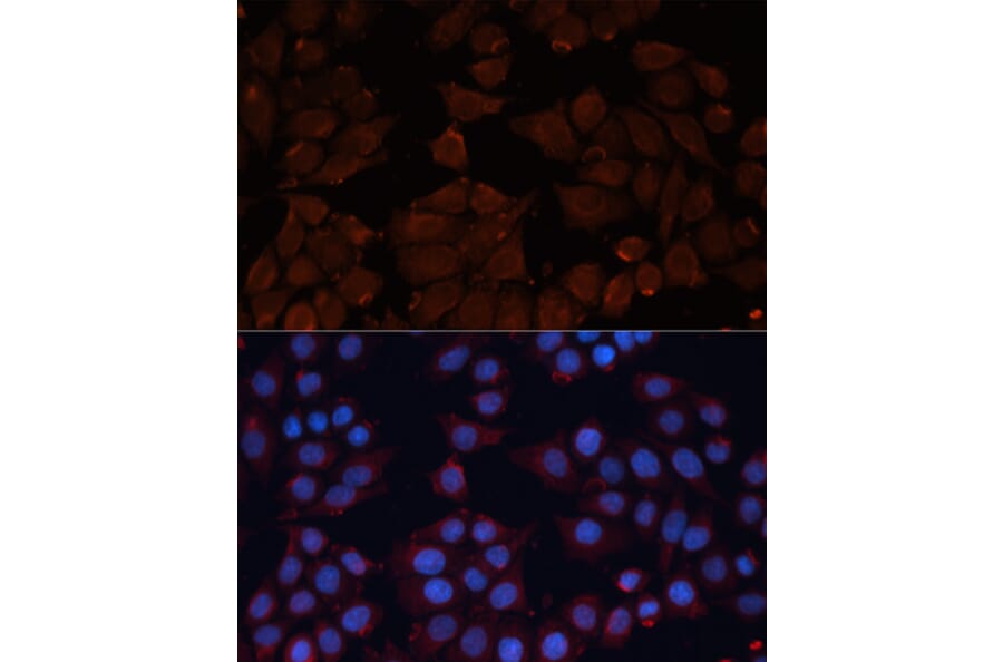 Immunofluorescence - Anti-ADAM12 Antibody (A15989) - Antibodies.com