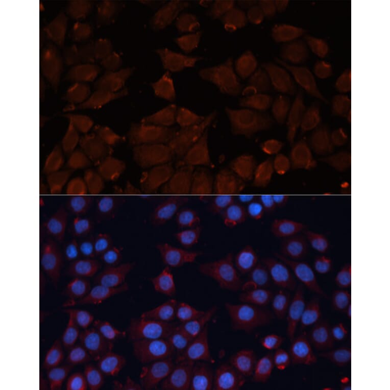 Immunofluorescence - Anti-ADAM12 Antibody (A15989) - Antibodies.com
