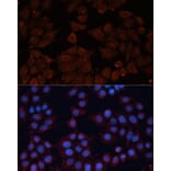 Immunofluorescence - Anti-ADAM12 Antibody (A15989) - Antibodies.com