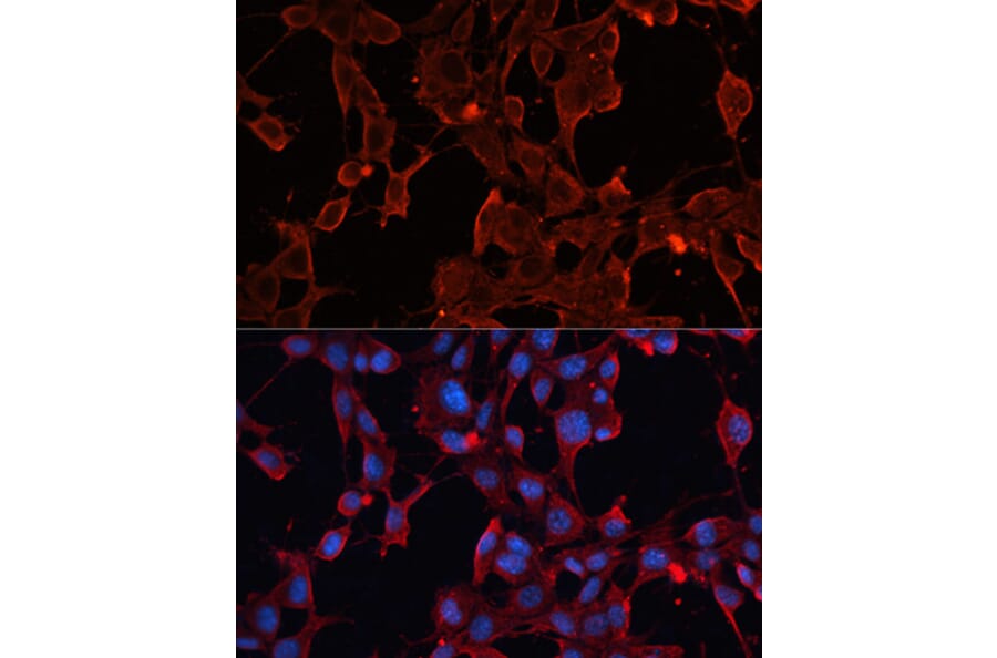 Immunofluorescence - Anti-ADAM12 Antibody (A15989) - Antibodies.com