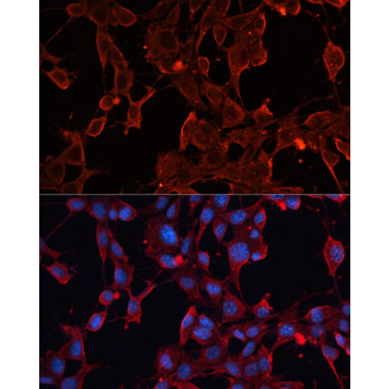 Immunofluorescence - Anti-ADAM12 Antibody (A15989) - Antibodies.com