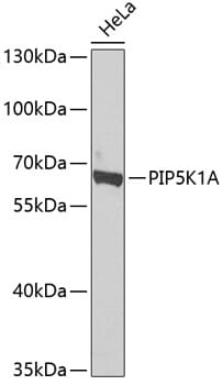 Western blot analysis of extracts of HeLa cells, using Anti-PIP5K1A Antibody (A7941) at 1:1,000 dilution.
Secondary antibody: Goat Anti-Rabbit IgG (H+L) (HRP) (AS014) at 1:10,000 dilution.
Lysates / proteins: 25µg per lane.
Blocking buffer: 3% non-fat dry milk in TBST.
Detection: ECL Basic Kit (RM00020).
Exposure time: 90s.