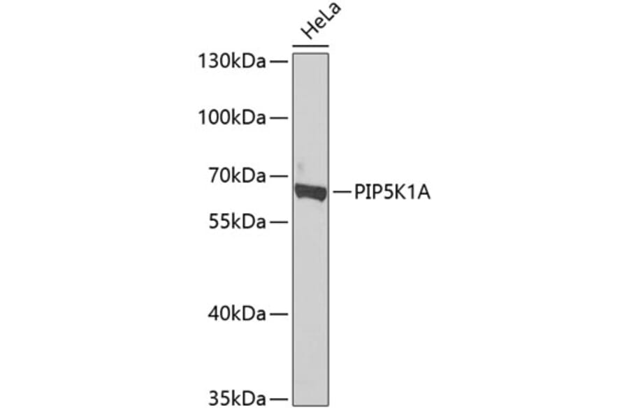 Western Blot - Anti-PIP5K1 alpha/PIP5K1A Antibody (A15990) - Antibodies.com
