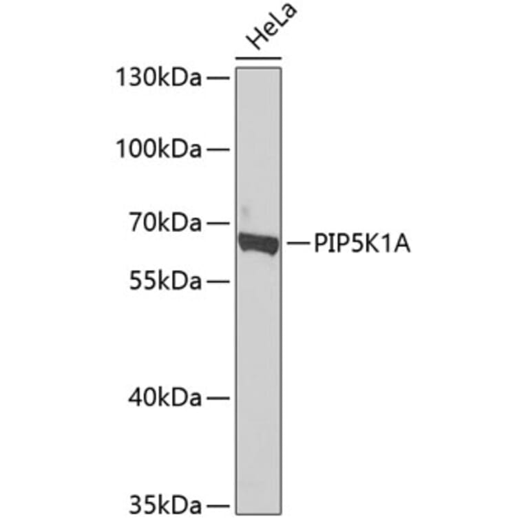 Western Blot - Anti-PIP5K1 alpha/PIP5K1A Antibody (A15990) - Antibodies.com