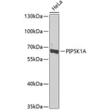 Western Blot - Anti-PIP5K1 alpha/PIP5K1A Antibody (A15990) - Antibodies.com