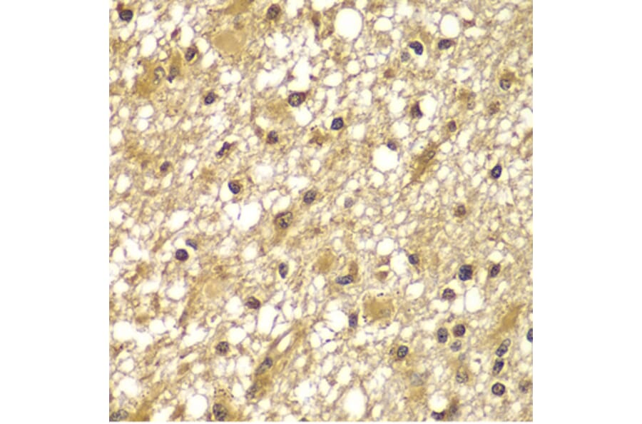 Immunohistochemistry - Anti-PIK3R3 Antibody (A7942) - Antibodies.com