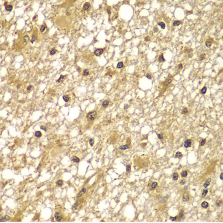 Immunohistochemistry - Anti-PIK3R3 Antibody (A7942) - Antibodies.com