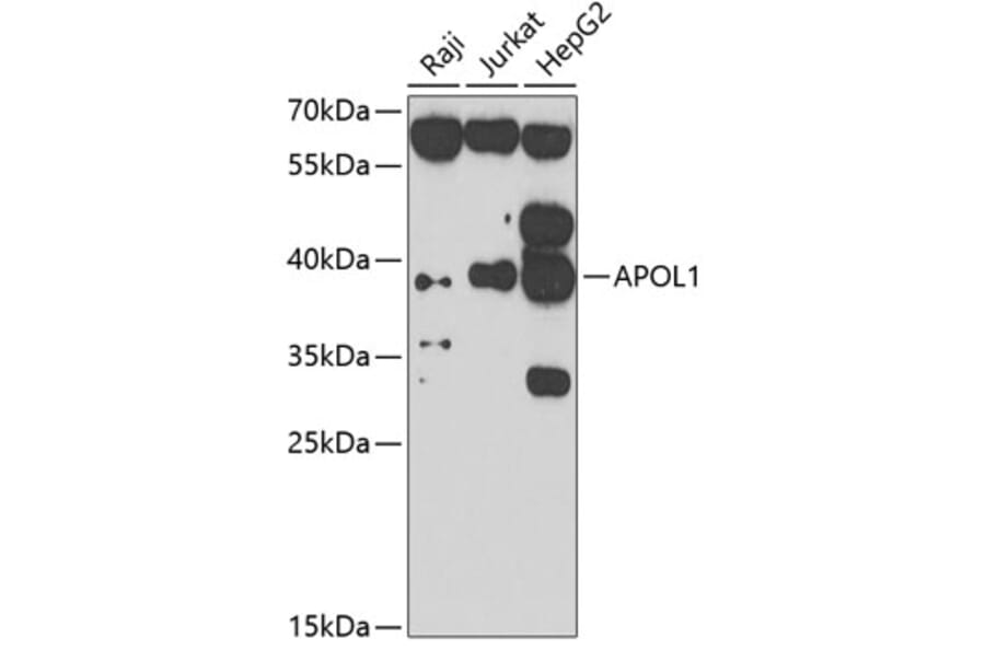 Western Blot - Anti-APOL1 Antibody (A7943) - Antibodies.com