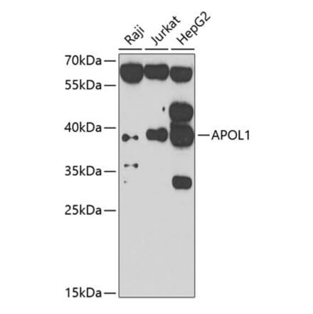 Western Blot - Anti-APOL1 Antibody (A7943) - Antibodies.com