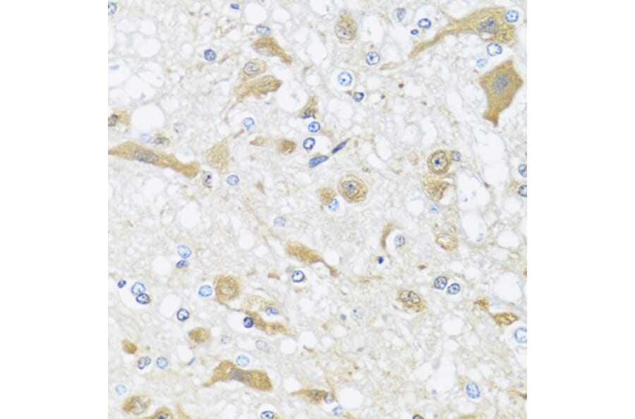 Immunohistochemistry - Anti-APOL1 Antibody (A7943) - Antibodies.com