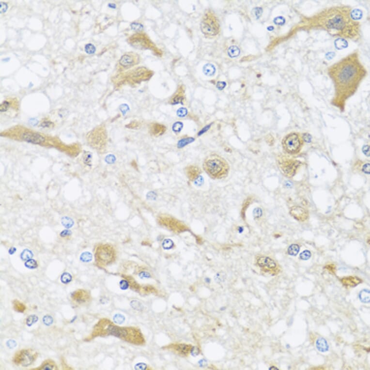 Immunohistochemistry - Anti-APOL1 Antibody (A7943) - Antibodies.com