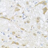 Immunohistochemistry - Anti-APOL1 Antibody (A7943) - Antibodies.com