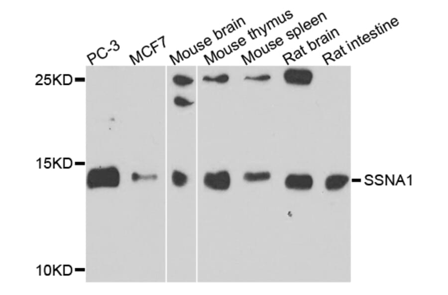 Western Blot - Anti-SSNA1 Antibody (A7944) - Antibodies.com
