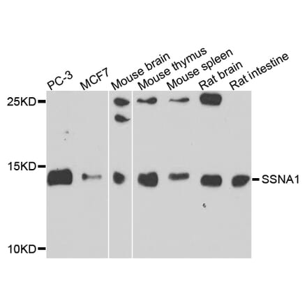 Western Blot - Anti-SSNA1 Antibody (A7944) - Antibodies.com