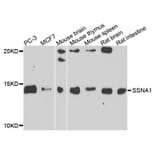 Western Blot - Anti-SSNA1 Antibody (A7944) - Antibodies.com