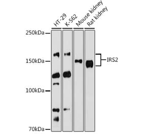 Western Blot - Anti-IRS2 Antibody (A15994) - Antibodies.com