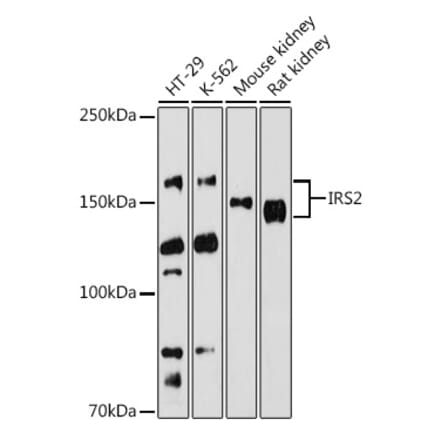 Western Blot - Anti-IRS2 Antibody (A15994) - Antibodies.com