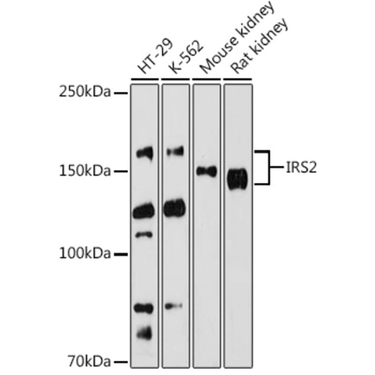 Western Blot - Anti-IRS2 Antibody (A15994) - Antibodies.com