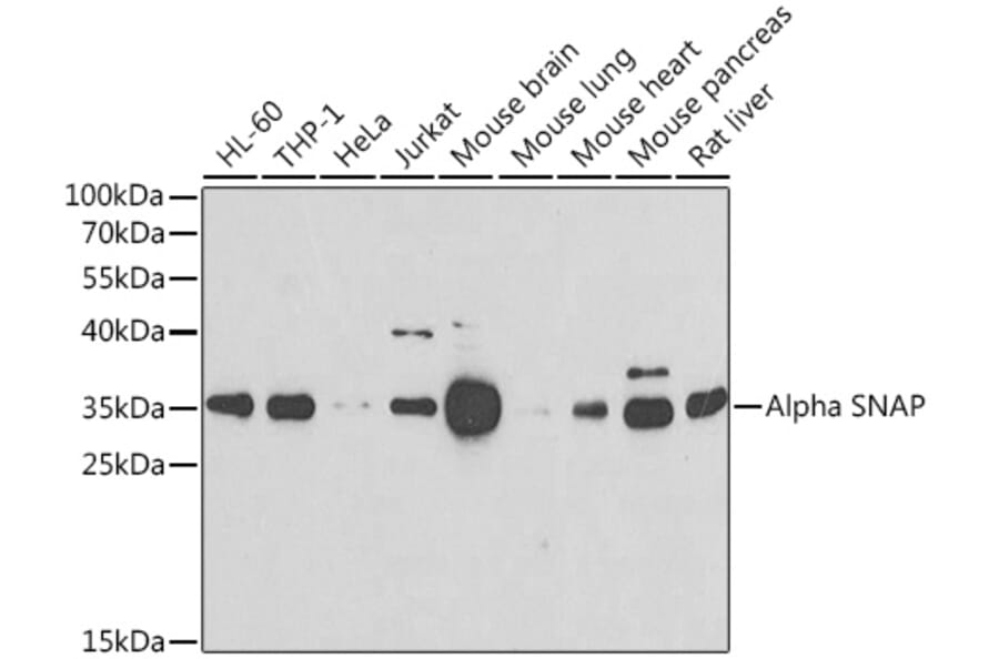 Western Blot - Anti-alpha SNAP Antibody (A15995) - Antibodies.com