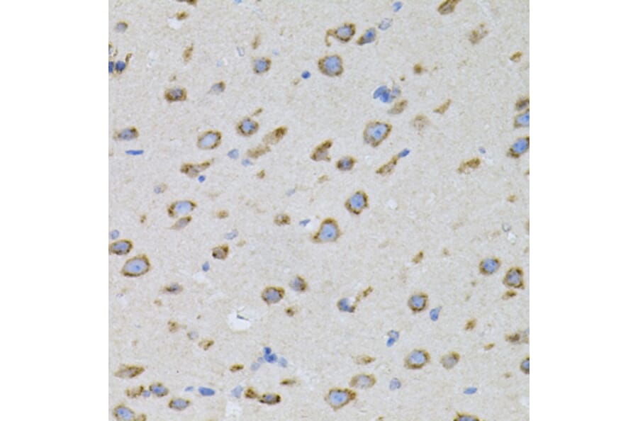 Immunohistochemistry - Anti-alpha SNAP Antibody (A15995) - Antibodies.com