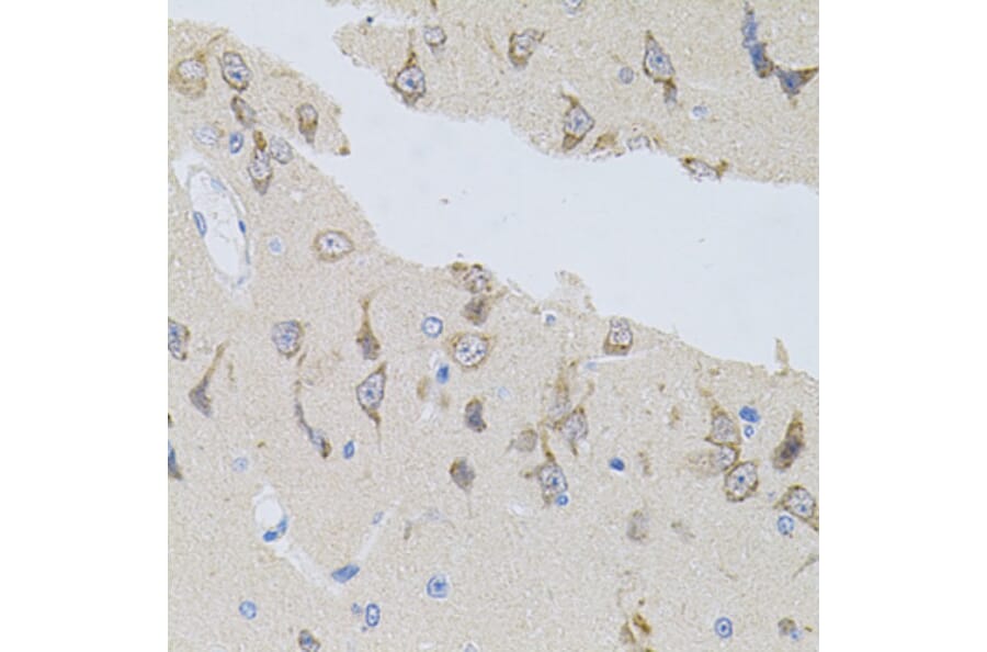 Immunohistochemistry - Anti-alpha SNAP Antibody (A15995) - Antibodies.com