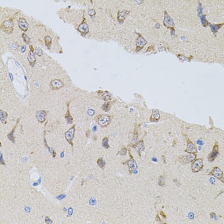 Immunohistochemistry - Anti-alpha SNAP Antibody (A15995) - Antibodies.com