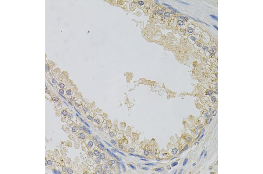 Immunohistochemistry - Anti-alpha SNAP Antibody (A15995) - Antibodies.com