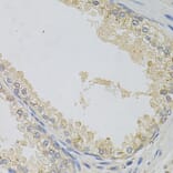 Immunohistochemistry - Anti-alpha SNAP Antibody (A15995) - Antibodies.com
