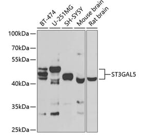 Western Blot - Anti-ST3GAL5 Antibody (A15996) - Antibodies.com