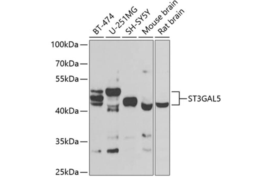 Western Blot - Anti-ST3GAL5 Antibody (A15996) - Antibodies.com